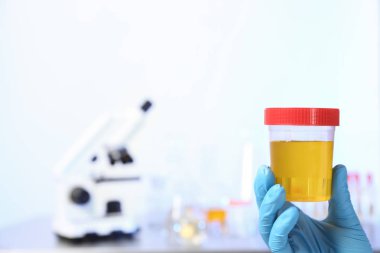 İdrar örneği kapsayıcısında kapalı, closeup ile metin için yer tutan laboratuvar asistanı. Tıbbi analiz
