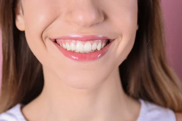 Mujer Joven Con Una Hermosa Sonrisa Primer Plano Dientes Sanos —  Fotos de Stock