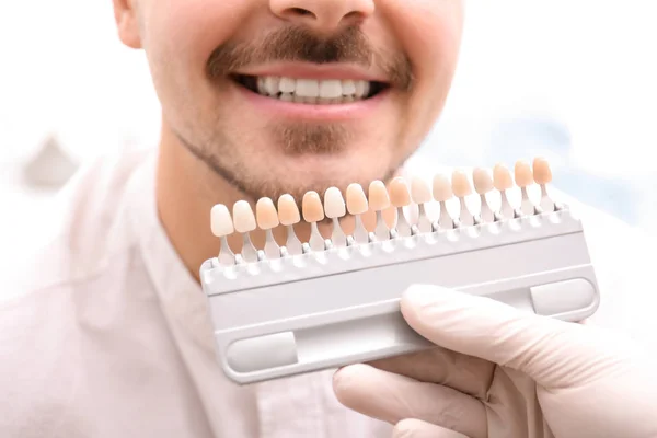 Zahnarzt Überprüft Zahnfarbe Des Jungen Mannes Nahaufnahme — Stockfoto