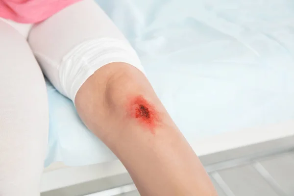 Little Girl Injured Leg Clinic Space Text First Aid — Stock Photo, Image