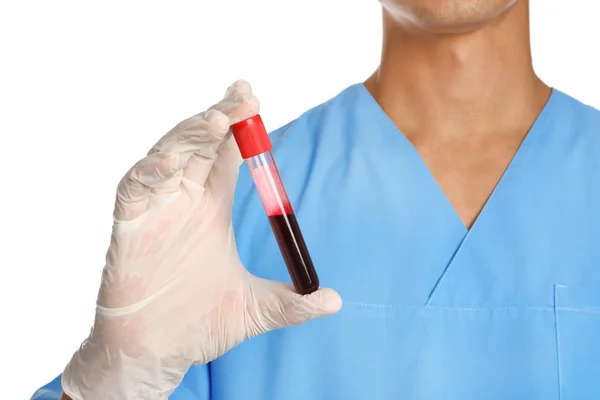 Arzt Reagenzglas Mit Blutprobe Auf Weißem Hintergrund Nahaufnahme Medizinisches Objekt — Stockfoto
