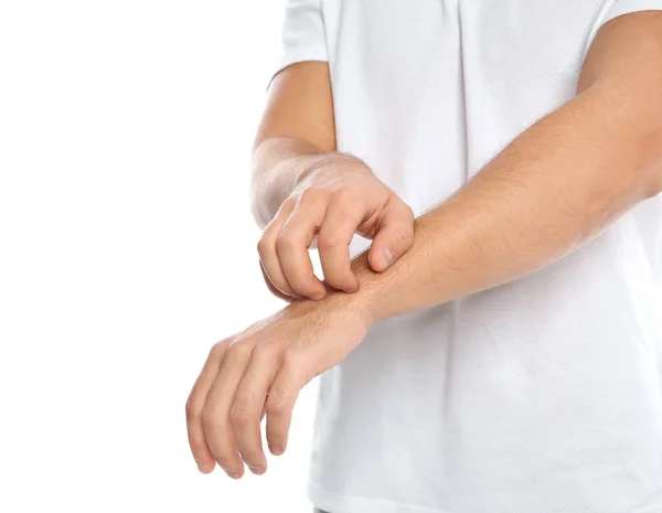 Young Man Scratching Arm White Background Closeup Annoying Itch — Stock Photo, Image