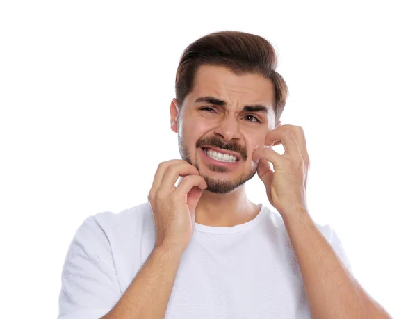 Jonge Man Gezicht Krabben Witte Achtergrond Vervelende Jeuk — Stockfoto