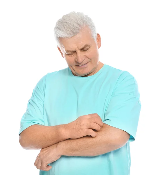 Mature Man Scratching Arm White Background Annoying Itch — Stock Photo, Image