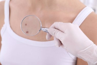 Dermatolog muayene hasta Büyüteç Kliniği, closeup görünümü ile