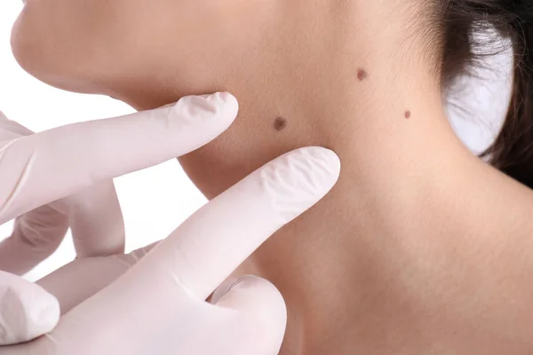 Dermatologist Examining Patient Clinic Closeup View — Stock Photo, Image