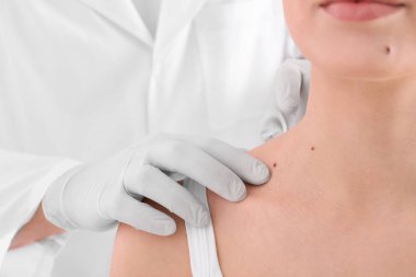 Dermatolog muayene hastada klinik, closeup görünümü