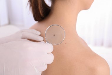 Dermatolog muayene hastada klinik, closeup görünümü
