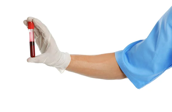 Arzt Reagenzglas Mit Blutprobe Auf Weißem Hintergrund Nahaufnahme Medizinisches Objekt — Stockfoto