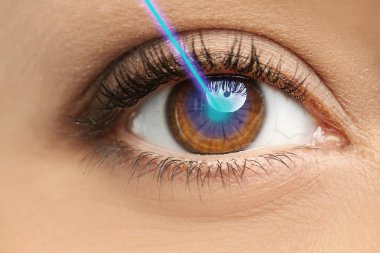 Lazer ve genç kadın, closeup göz. Vizyon Düzeltme için doktoru ziyaret