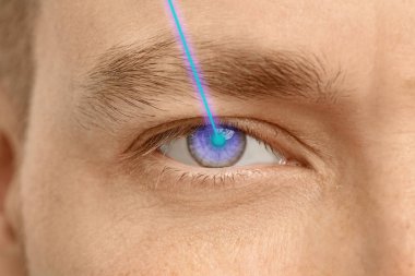 Lazer ve genç bir adam, closeup göz. Vizyon Düzeltme için doktoru ziyaret