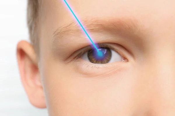 レーザーと小さな男の子 目のクローズ アップ 視力矯正のための眼科医を訪問 — ストック写真