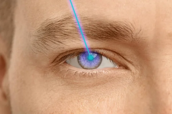 Laser Młody Człowiek Zbliżenie Oczu Odwiedzając Okulista Korekcji Wzroku — Zdjęcie stockowe