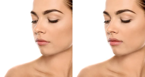 白い背景に クローズ アップの唇増大術前後の女性 — ストック写真