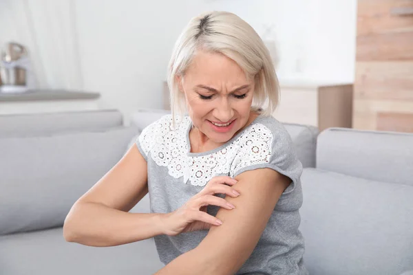 Mature Woman Scratching Arm Home Annoying Itch — Stock Photo, Image