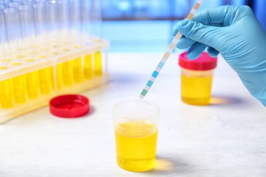 Laboratuar asistanı ile idrar örneği ve tablo, closeup turnusol kağıdı analiz yapıyor