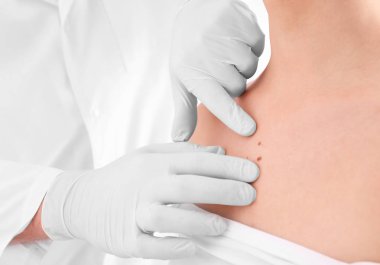 Dermatolog muayene hastada klinik, closeup görünümü