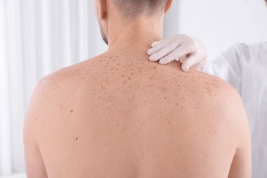 Doktor muayene hasta Kliniği, closeup görünümü. Dermatolog ziyaret