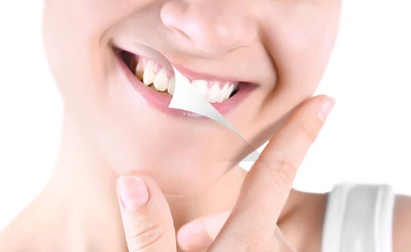 Усміхнена Молода Жінка Після Процедури Відбілювання Зубів Світлому Фоні Крупним — стокове фото