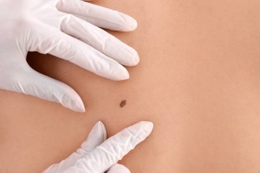 Dermatolog muayene hastada klinik, closeup görünümü