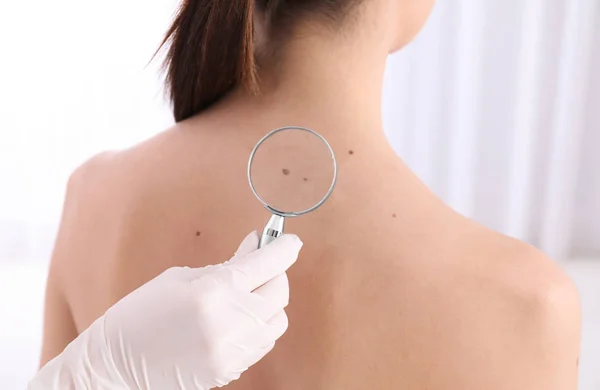 Dermatologista Examinando Paciente Com Lupa Clínica Vista Close — Fotografia de Stock