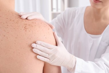 Doktor muayene hasta Kliniği, closeup görünümü. Dermatolog ziyaret