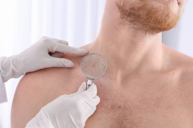 Dermatolog muayene hasta Büyüteç Kliniği, closeup görünümü ile