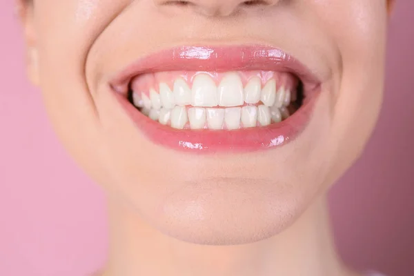 Молода Жінка Здоровими Зубами Красивою Посмішкою Кольоровому Фоні Крупним Планом — стокове фото