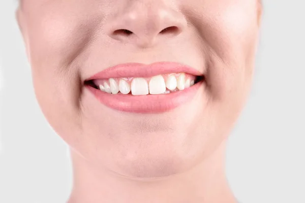 年轻的妇女与健康的牙齿微笑在白色背景 特写镜头 — 图库照片