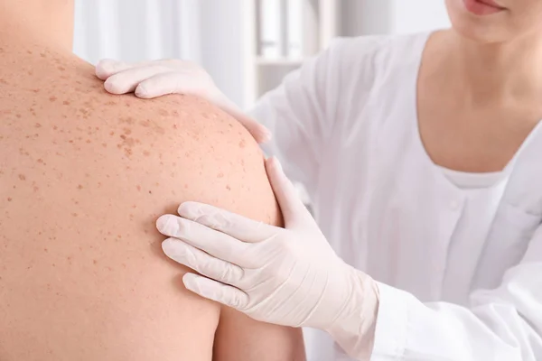 Doktor Vyšetřující Pacient Klinice Detailní Zobrazení Návštěva Dermatologa — Stock fotografie