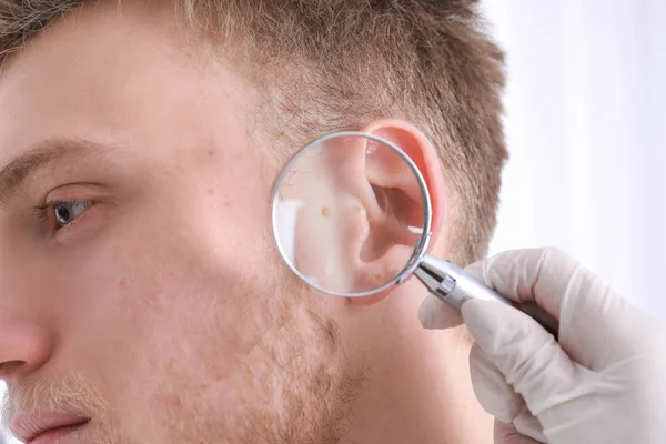 Dermatologista Examinando Paciente Com Lupa Clínica Vista Close — Fotografia de Stock