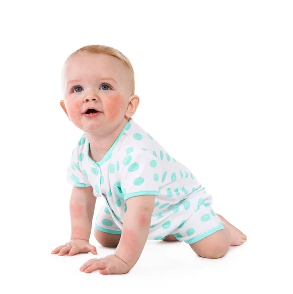 白い背景のアレルギーと愛らしい小さな赤ちゃん — ストック写真