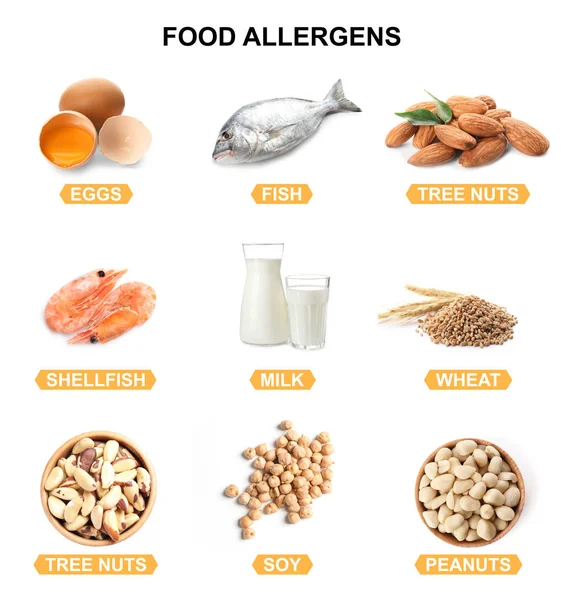 Set Different Products Causing Food Allergies White Background — Stock Photo, Image