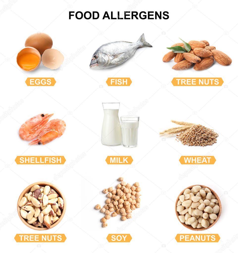 Set of different products causing food allergies on white background 