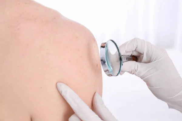 Δερματολόγος Εξετάζει Ασθενή Μεγεθυντικό Φακό Στην Κλινική Closeup Προβολή — Φωτογραφία Αρχείου