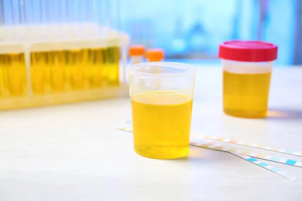 Contenitore Con Campione Urina Analisi Sul Tavolo Laboratorio — Foto Stock