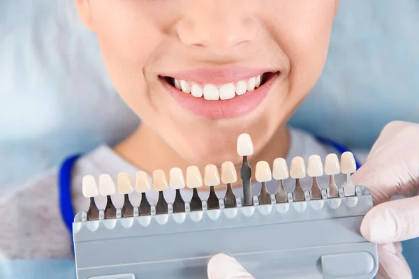 Dentista Seleccionando Color Los Dientes Del Paciente Con Paleta Clínica —  Fotos de Stock