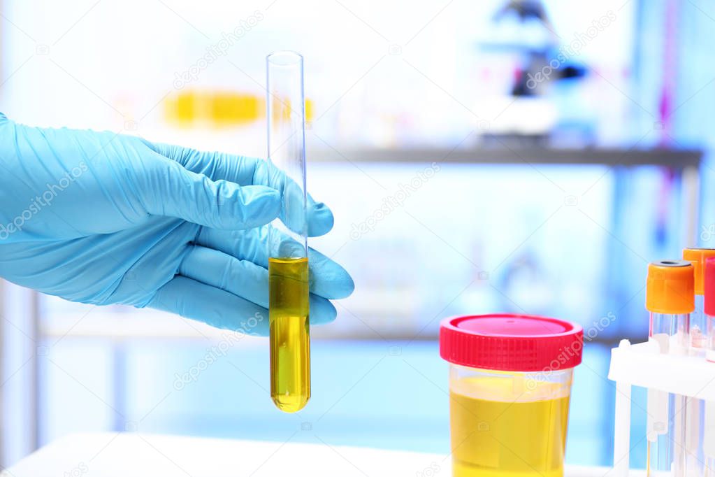 Laboratory assistant holding test tube with urine sample for analysis indoors, closeup