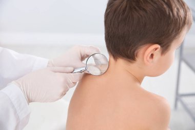 Küçük çocuğun doğum lekesi Büyüteç Kliniği ile inceleyerek dermatolog