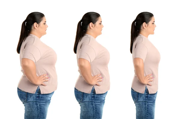 Υπέρβαρη Γυναίκα Πριν Και Μετά Την Απώλεια Βάρους Λευκό Φόντο — Φωτογραφία Αρχείου