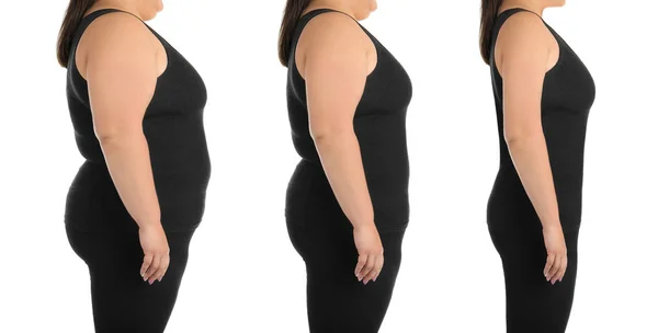 Избыточный Вес Женщины После Потери Веса Белом Фоне Крупный План — стоковое фото
