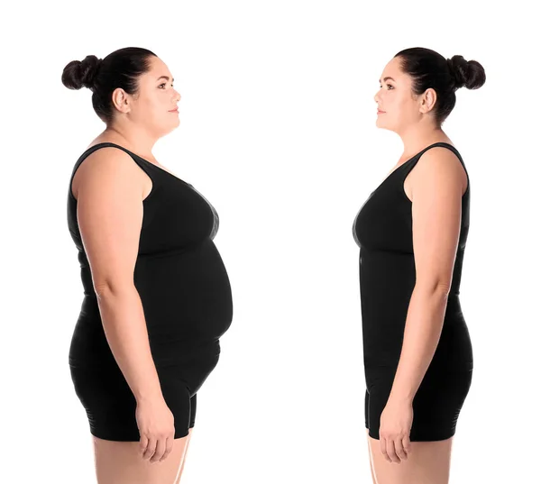Übergewichtige Frau Vor Und Nach Gewichtsverlust Auf Weißem Hintergrund — Stockfoto