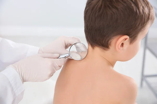 Dermatolog Badając Znamię Małego Chłopca Lupą Klinice — Zdjęcie stockowe