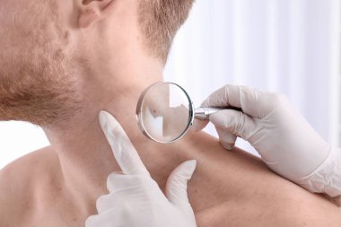 Dermatolog muayene hasta Büyüteç Kliniği, closeup görünümü ile