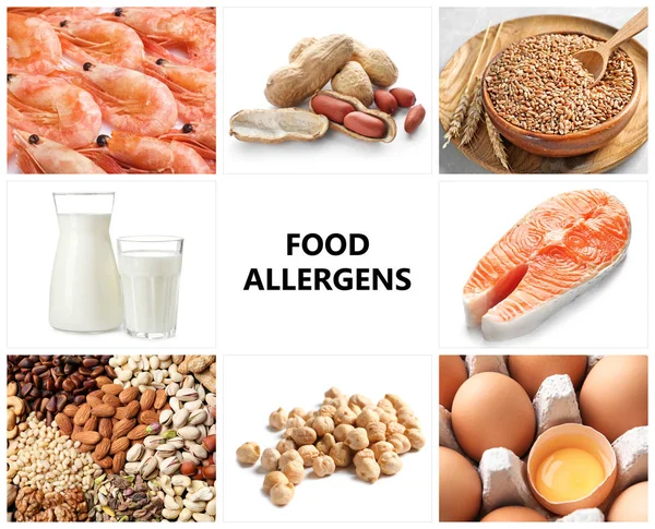 Set Van Verschillende Producten Veroorzaakt Door Allergieën Van Het Voedsel — Stockfoto