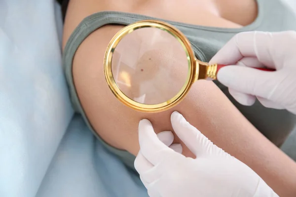 Dermatologista Examinando Marca Nascença Paciente Com Lupa Clínica Close — Fotografia de Stock
