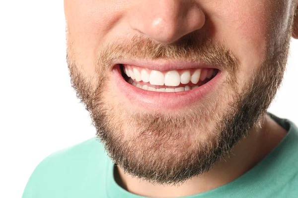 Hombre Joven Con Dientes Sanos Sobre Fondo Blanco Primer Plano —  Fotos de Stock