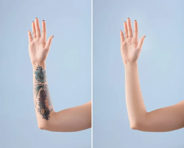 Young woman before and after laser tattoo removal procedure on color background, closeup