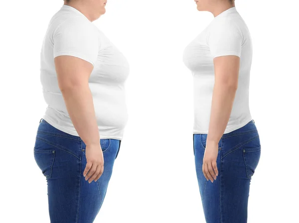 Übergewichtige Frau Vor Und Nach Der Gewichtsabnahme Auf Weißem Hintergrund — Stockfoto