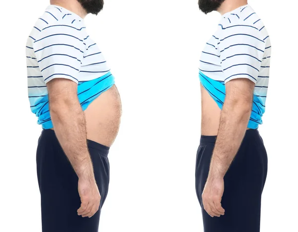 Υπέρβαροι Άνθρωπος Πριν Και Μετά Την Απώλεια Βάρους Άσπρο Φόντο — Φωτογραφία Αρχείου